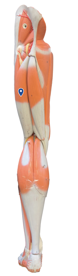 <p>What muscle is the arrow pointing to?</p>