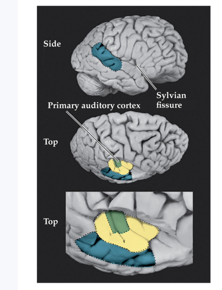 <p><span>The first stages of auditory processing begin in the temporal lobe of the cerebral cortex within the Sylvian fissure. The top picture is a side view of the brain’s right hemisphere (the front of the brain faces right). The lower two pictures are looking down at the interior of the right hemisphere, with the parietal cortex cut away. Primary auditory cortex (A1) is surrounded by belt regions, and parabelt regions extend past the belt to the front and side. These belt regions are sometimes called secondary or associational auditory areas</span></p>
