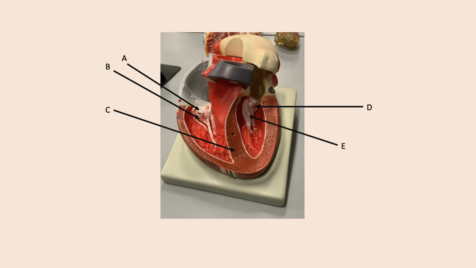 <p>what is A</p>