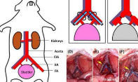 <p>inadequate blood supply to organ or tissue</p>
