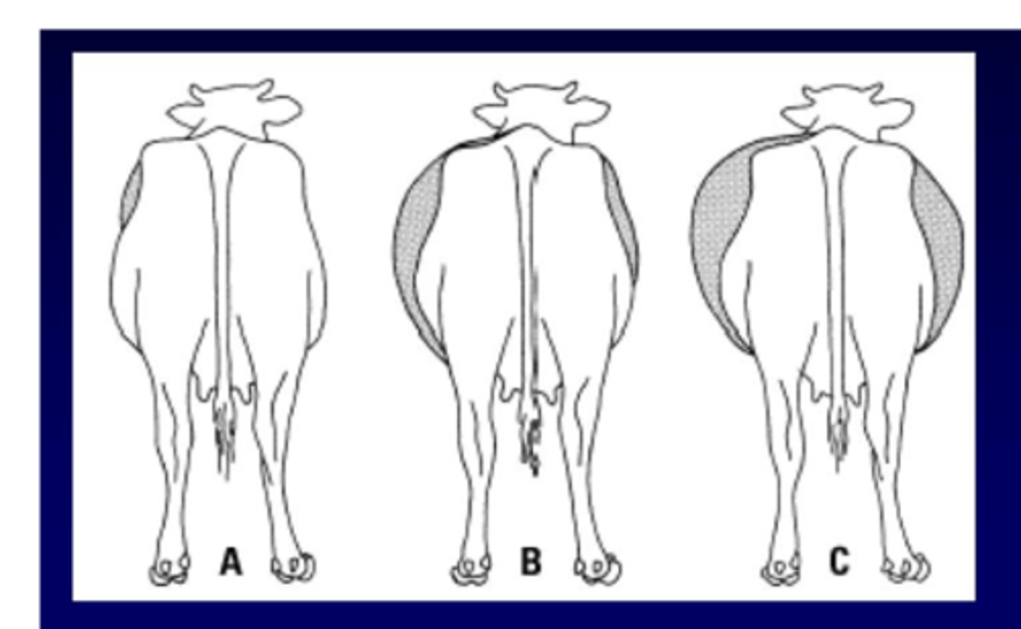 <p>left</p><p>then as it continues, it can distend the entire abdomen</p>