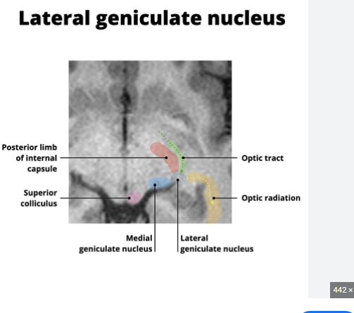 <p>sits posterior to thalamus </p>