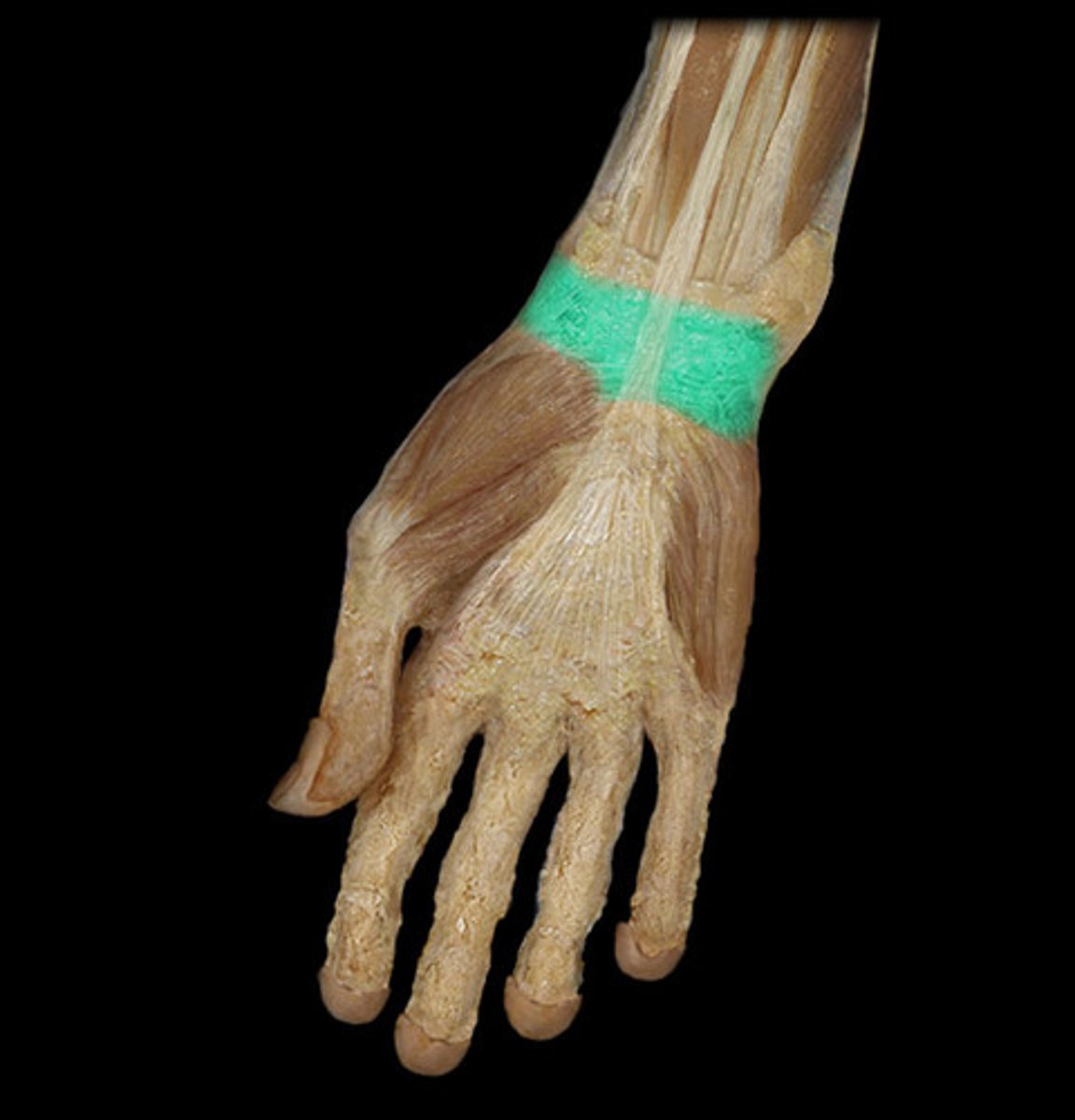 <p>forms the roof of the carpal tunnel, which contains flexor tendons and the median nerve</p>