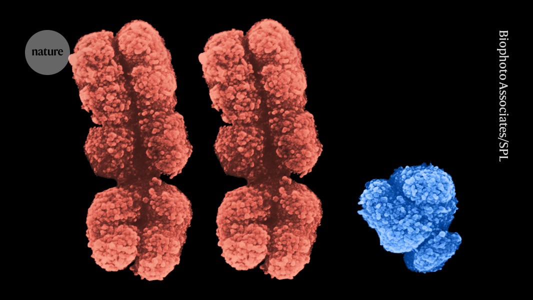 <p>Disorders such as Turner syndrome (XO) and Klinefelter syndrome (XXY). (an extra chromosome) +1</p>