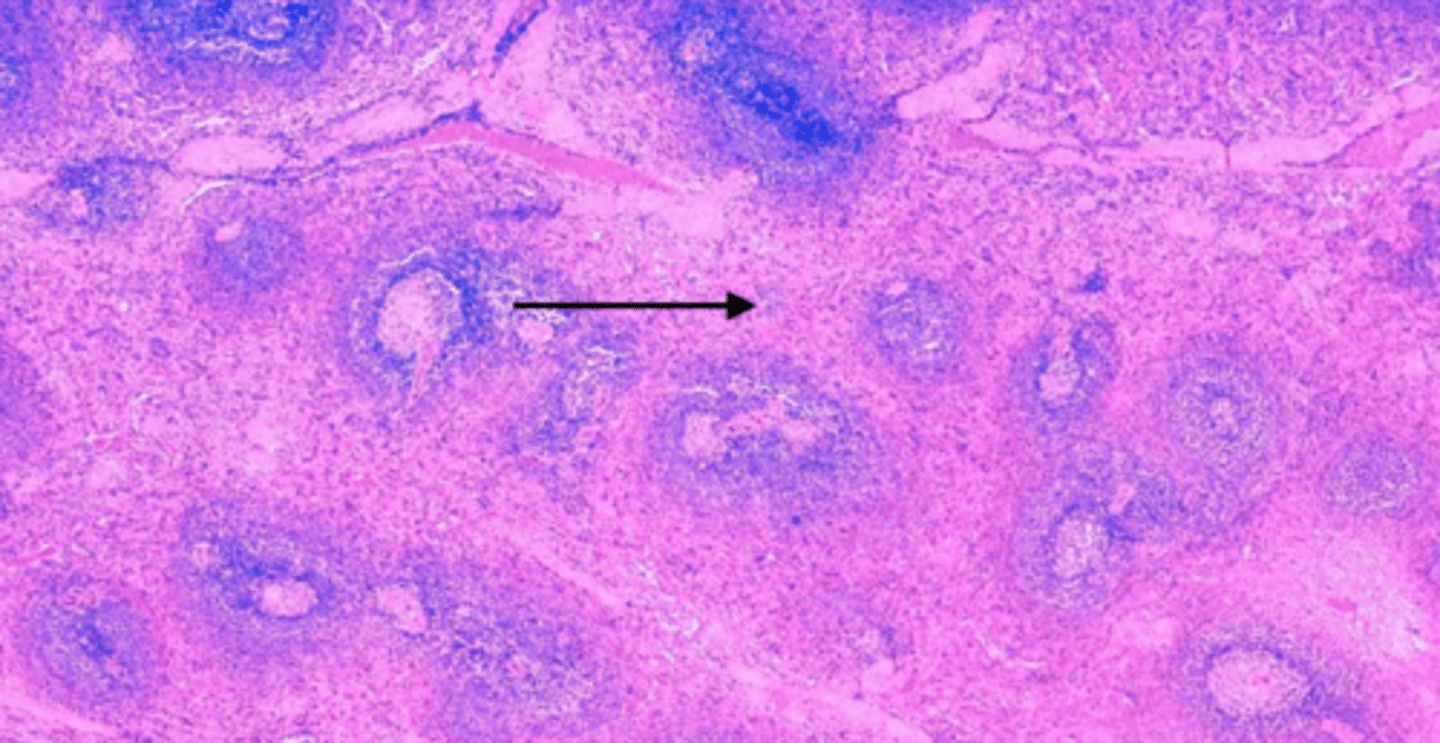 <p>In spleen</p>