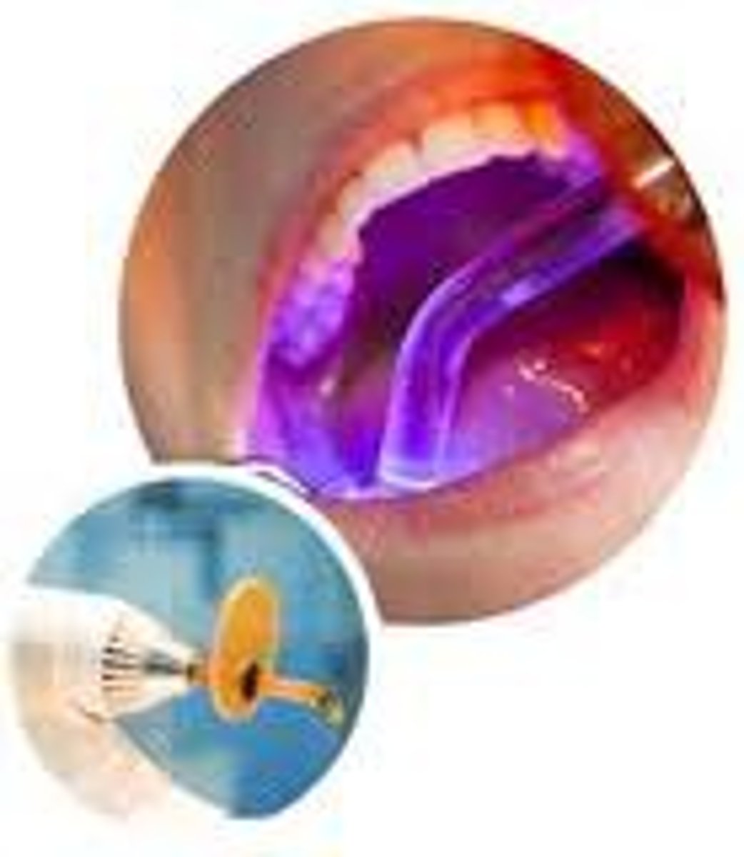 <p>Light that hardens or sets many dental materials</p>