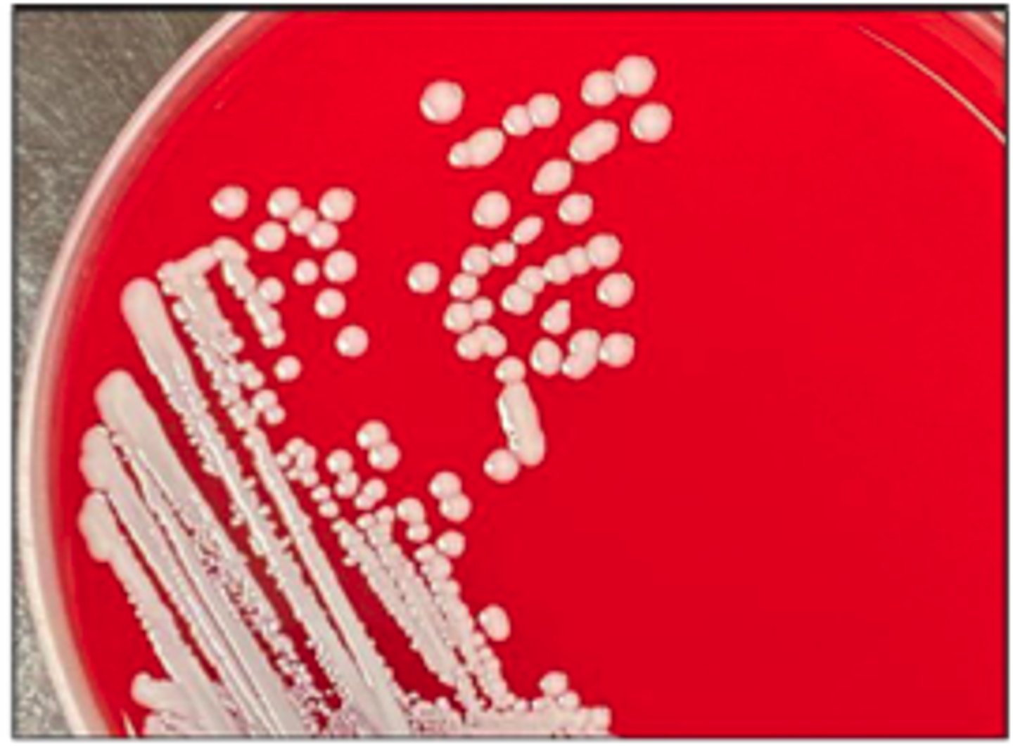 <p>This IS a Staph species it has ________ hemolysis so must be ____________</p>