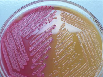 <ul><li><p><strong>Purpose</strong>: to differentiate between lactose fermenting G- bacteria and lactose non-fermenting G- bacteria</p></li><li><p><strong>Medium</strong>: crystal violet and bile salts</p></li><li><p><strong>Type of Medium</strong>: selective and differential</p></li><li><p><strong>+ results</strong> = pink colonies</p></li><li><p><strong>- results</strong> = no color change</p></li><li><p><strong>significant specific ingredients</strong>:</p></li><li><p><strong>reagents/indicators</strong>:</p><ul><li><p>Crystal violet and bile salts inhibit Gram (+) bacteria</p></li><li><p>and neutral red dye stains microbes fermenting lactose (and thereby decreasing the pH) a pink color.</p></li></ul></li><li><p><strong>specific directions</strong> (if any): streak agar in a straight line and incubate</p></li><li><p><strong>significant results</strong>:</p></li></ul>