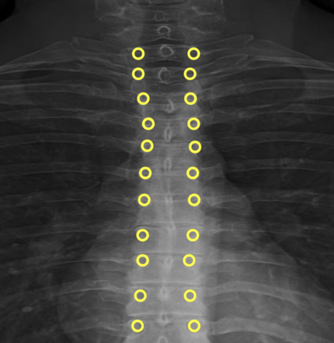 <p>What are the yellow circles?</p>