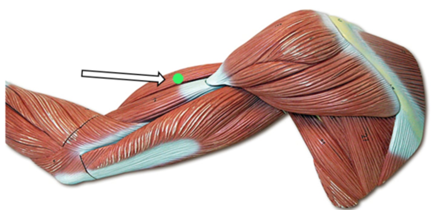 <p>biceps brachii (function)</p>