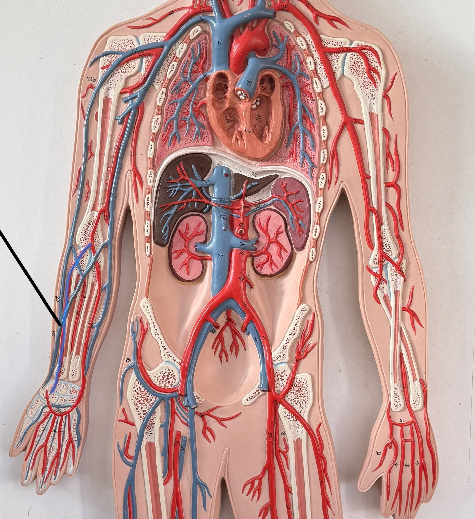 <p>Which artery is this?</p>