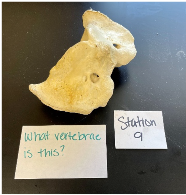 <p>What vertebrae is this?</p>