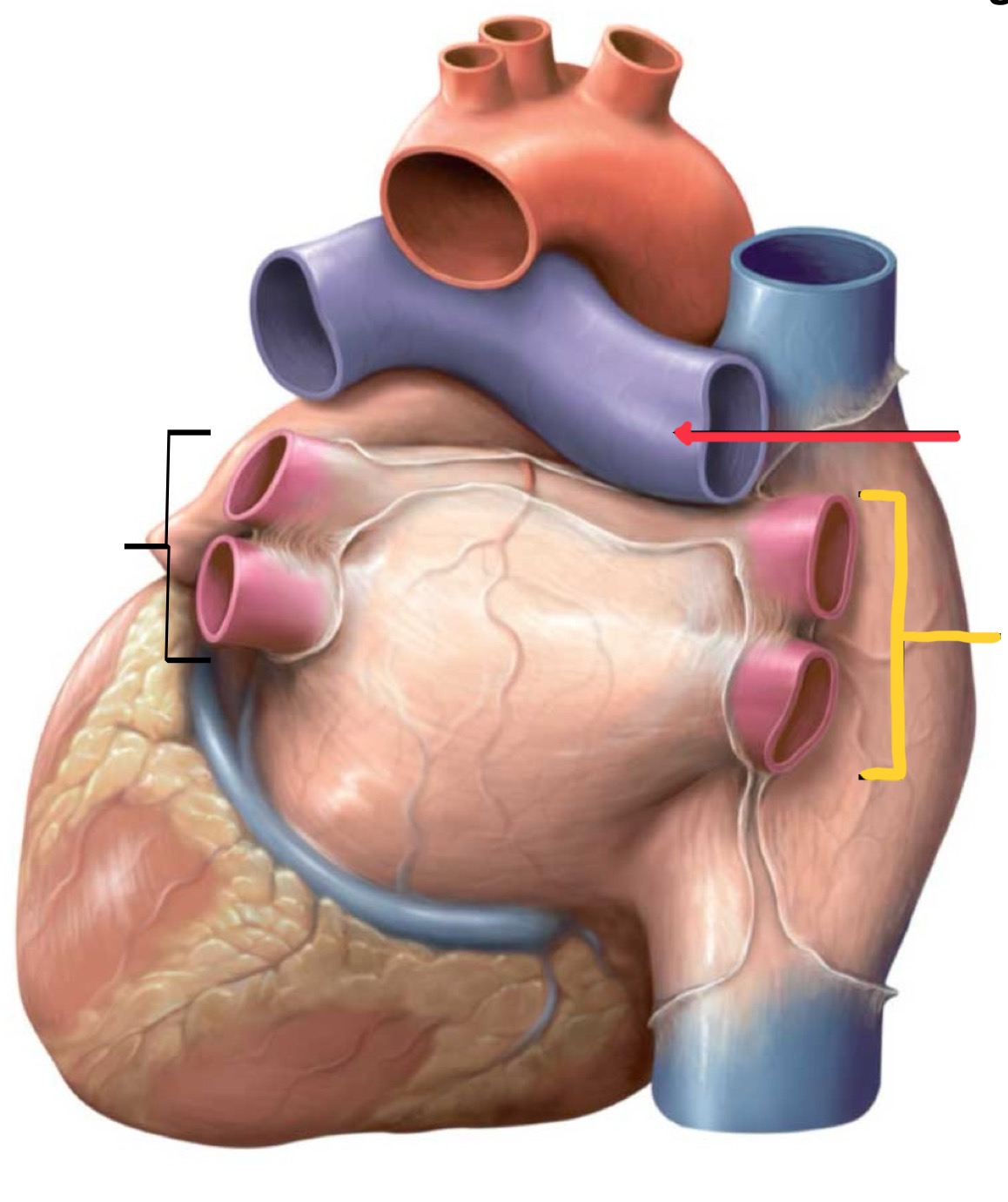 <p>What structure is identified by the black line?</p>
