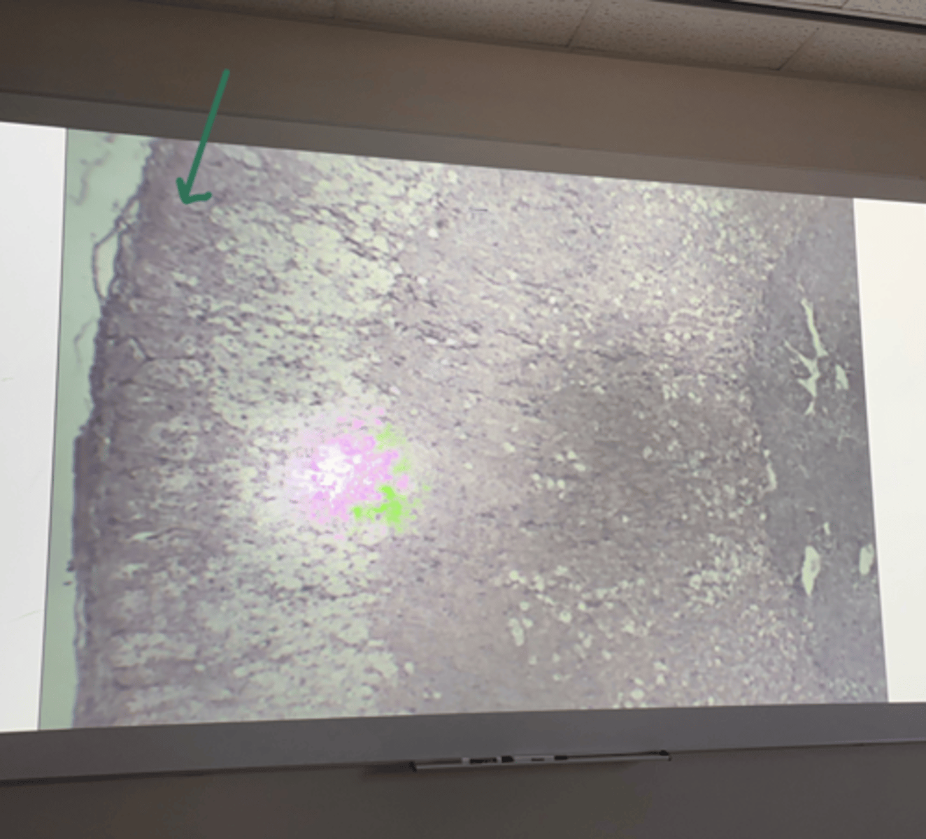 <p>gland and structure</p>