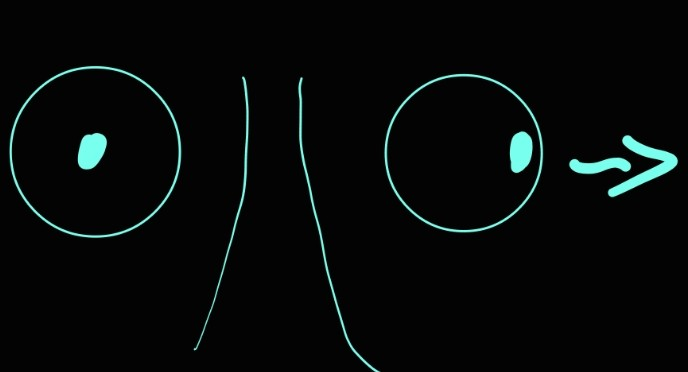 <p>cranial nerve VI</p>