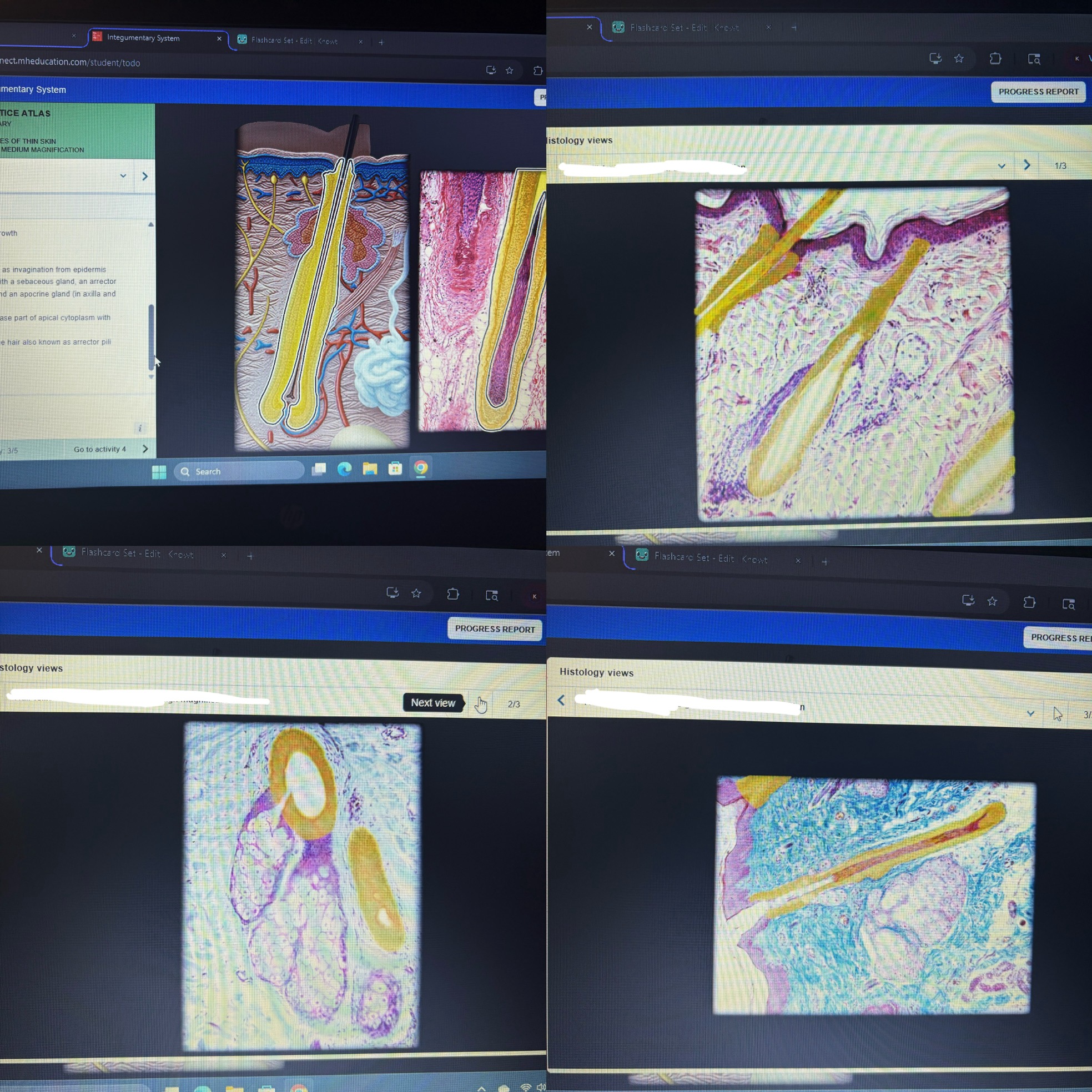 <p>Location- dermis may extend into hypodermis </p><p>Function is for hair formation and growth</p>