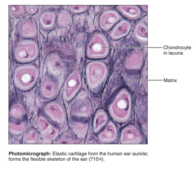 <p>cartilage with abundant elastic fibers; more flexible than hyaline cartilage</p>