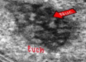 <p>Euchromatin</p>