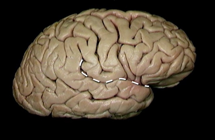 term image