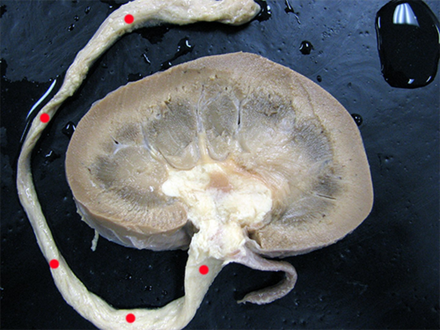 <p>Dissection of a kidney</p>