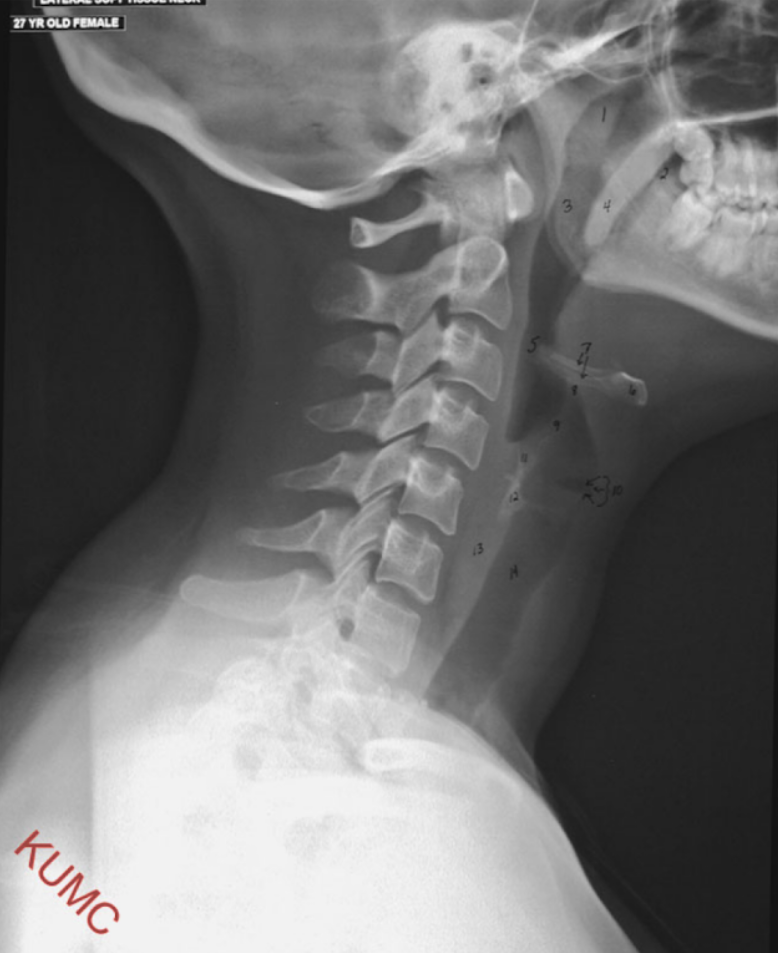 <p>Describe this image</p>