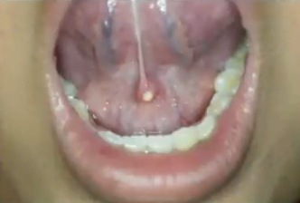 <p>what is the diagnosis </p>