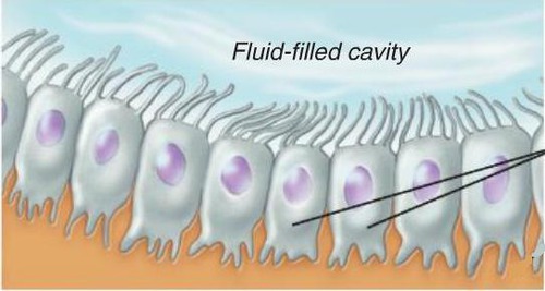 <p>Secrete CSF, ions, proteins, etc. Line the ventricles</p>