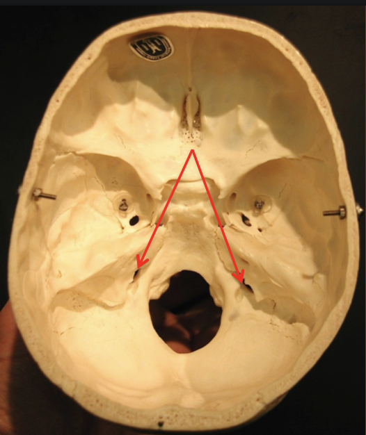 term image