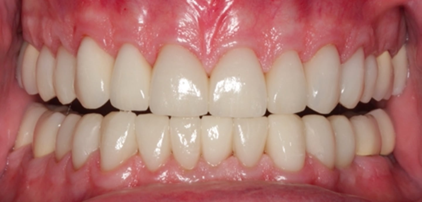 <p>ID the mandibular movement/position</p>