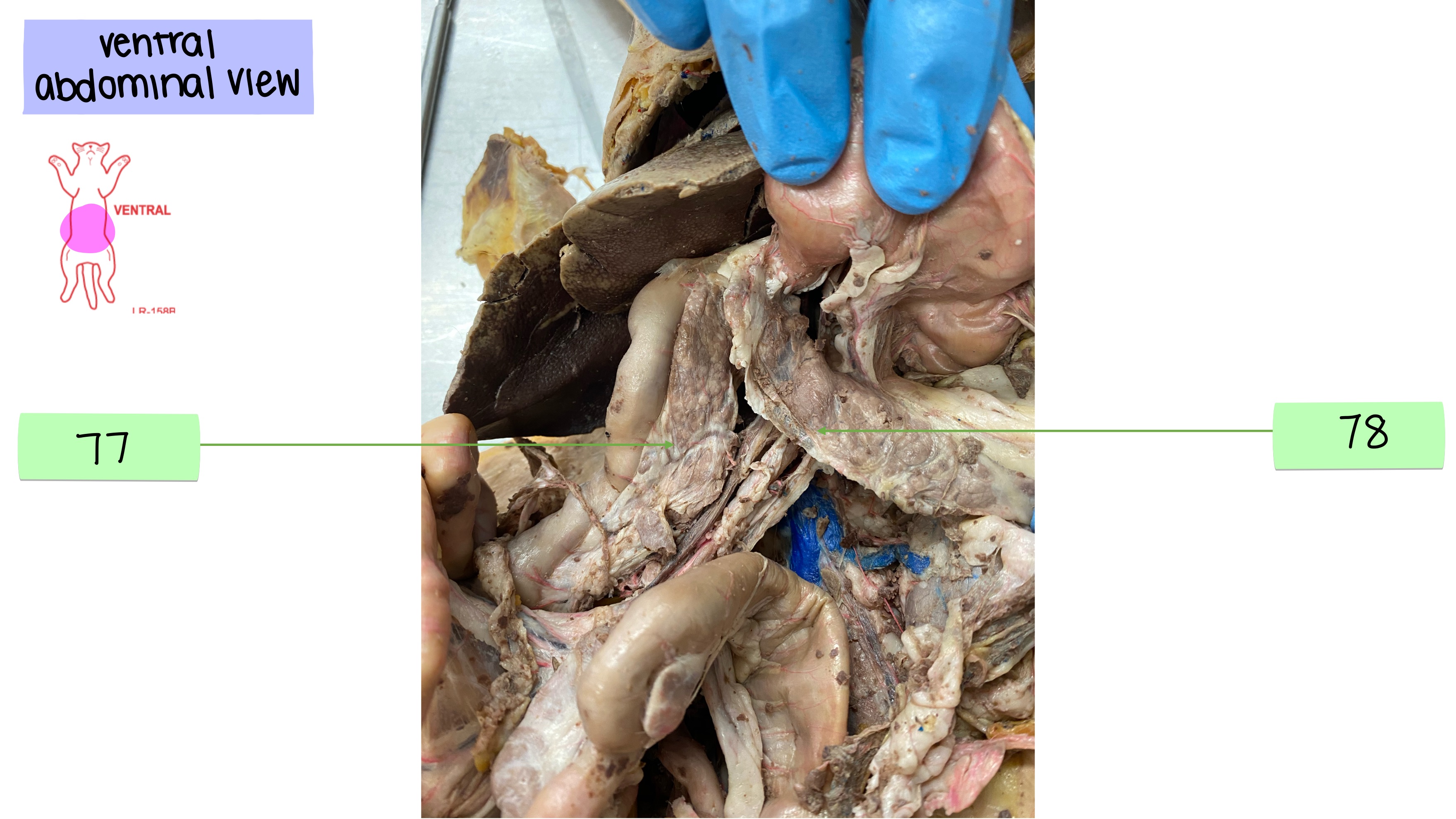 <p>pancreas head</p>