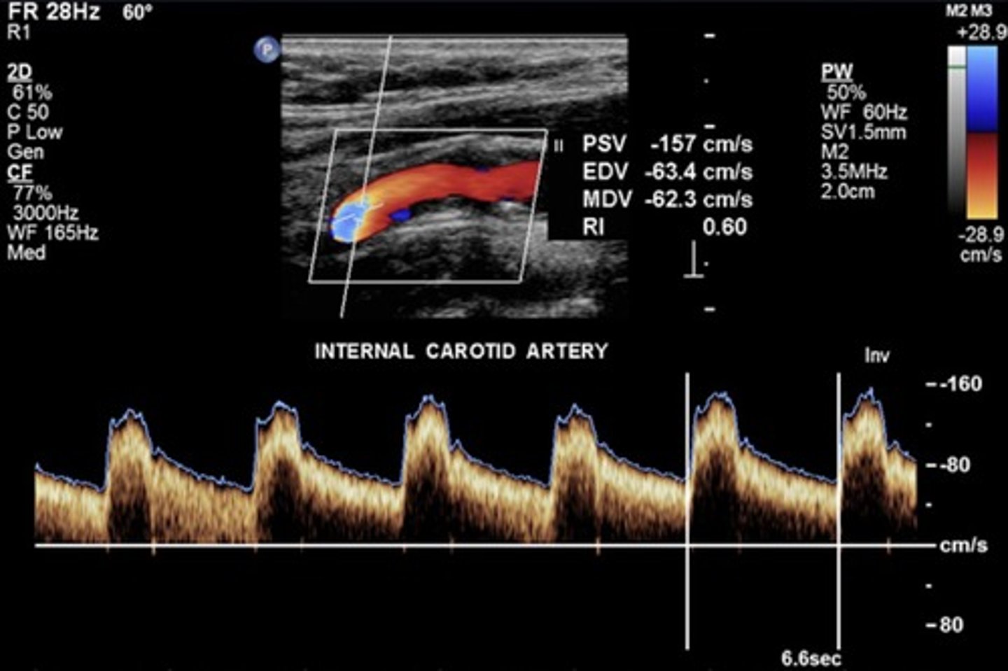 <p>Lowest resistance</p>