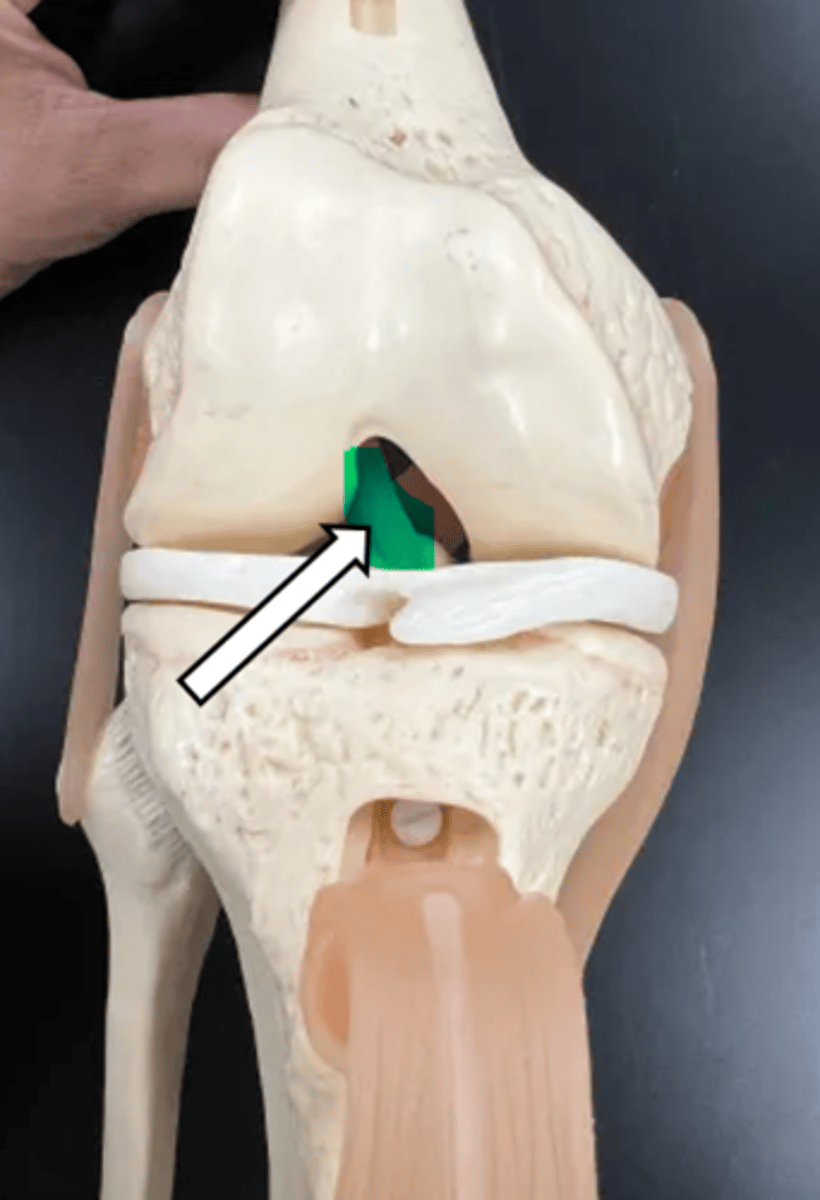 <p>name the articulation/joint</p>