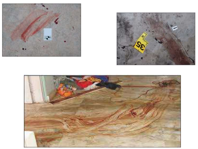 <p>What bloodstain pattern are these? </p>
