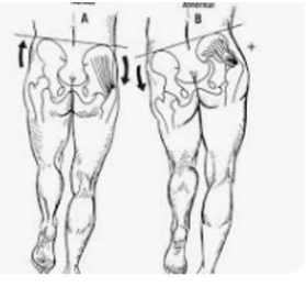 <ul><li><p><strong>Test for:</strong> congenital hip dislocation or hip abductor weakness</p></li><li><p><strong>Positive sign:</strong> <strong>hip drops on the side opposite the stance leg</strong> or in babies, <strong>leg elevates</strong> when standing/walking</p></li></ul><p></p>