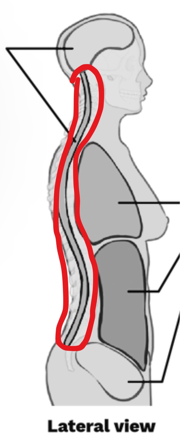 <p>What cavity is this?</p>
