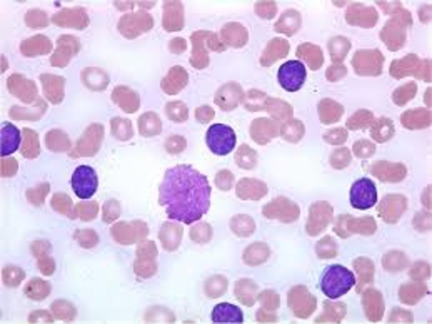 <p>- RBCs = easy to spot, no nucleus.</p><p>- neutrophil = nucleus is multi-lobed, grainy cytoplasm.</p><p>- monocyte = biggest WBC, type of phagocyte. Kidney-bean shaped nucleus, non-grainy cytoplasm.</p><p>- lymphocyte = nucleus takes u most of cell, little (non-grainy) cytoplasm to be seen.</p>