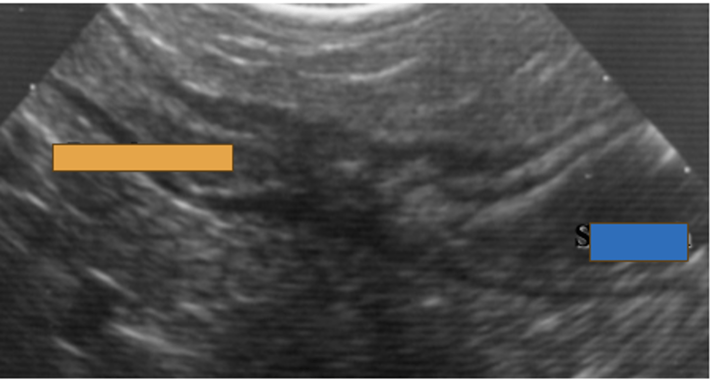 <p>ID two gastric structures</p>