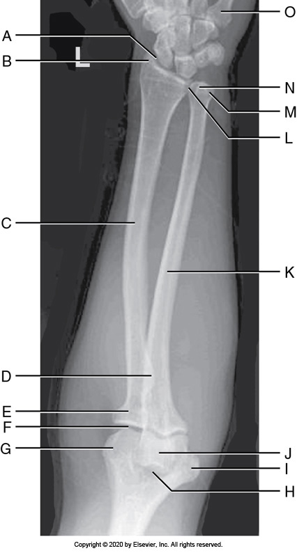 <p>Identify the labeled anatomy "B" in the image below:</p><p>Radial tuberosity</p><p>&nbsp;</p><p>Olecranon fossa</p><p>&nbsp;</p><p>Radial styloid</p><p>&nbsp;</p><p>Ulnar styloid</p>