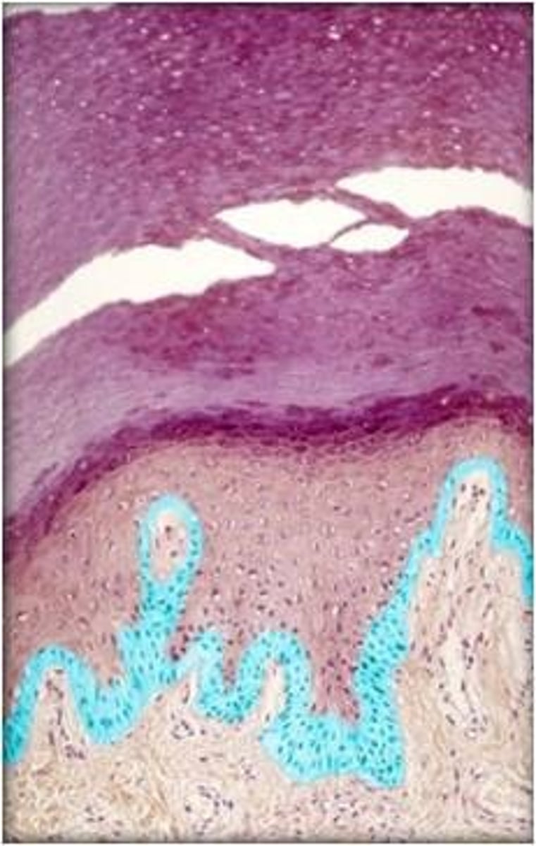 <p>the deepest layer of the epidermis consisting of stem cells capable of undergoing cell division to form new cells</p>