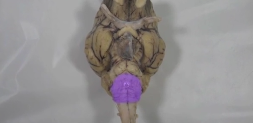 <p>Medulla oblongata </p>