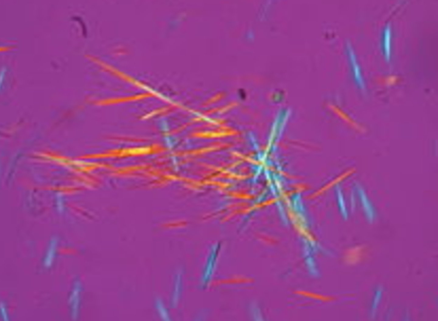 <p>aids in identification of cholesterol in oval fat bodies, fatty casts, and crystals</p>