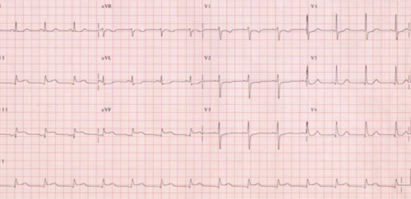 <p>What are the findings</p>