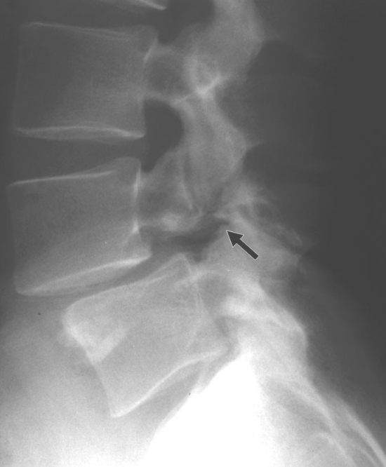 <p>Name this pathology</p>