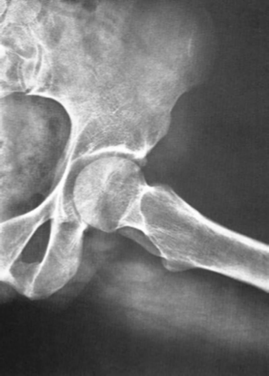 <p>ID standard unilateral hip projection</p>
