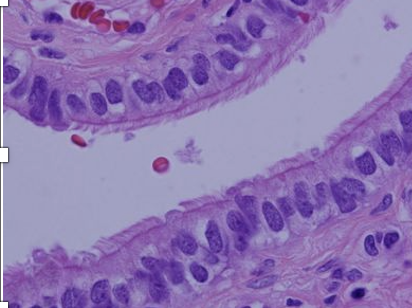 <p>What type of tissue is this?</p>