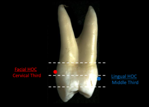 <p>middle 1/3</p>