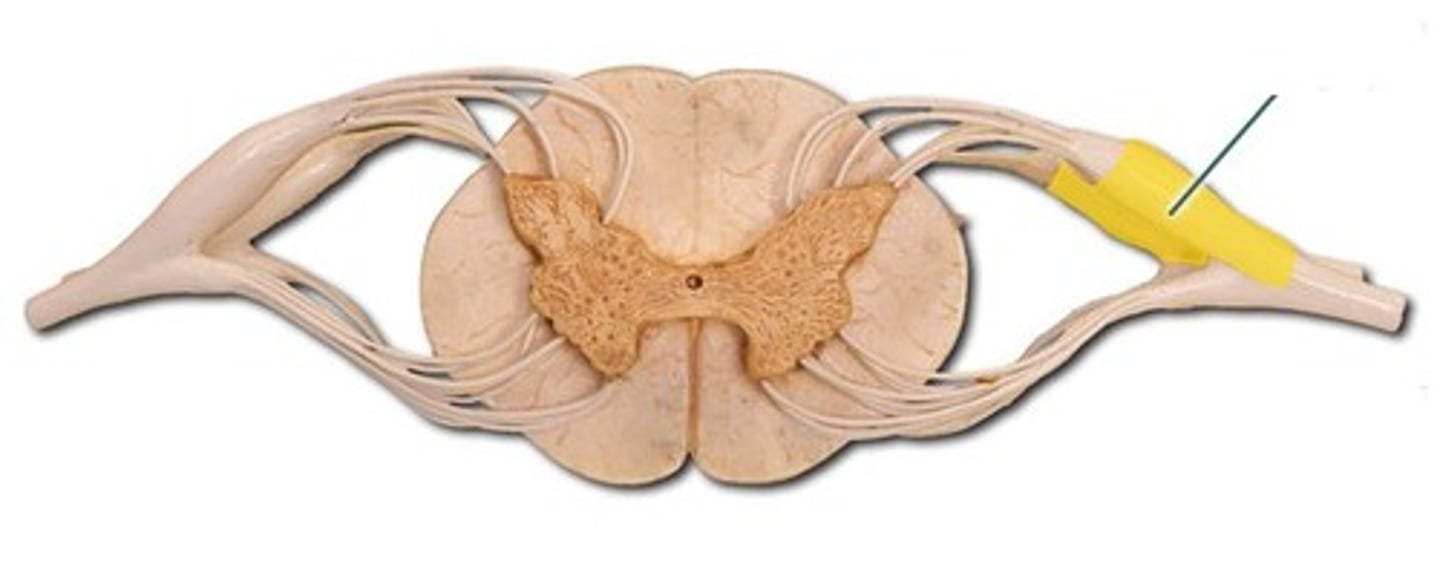 <p>enlarged section of posterior spinal nerve root that contains cell bodies of sensory neurons</p>