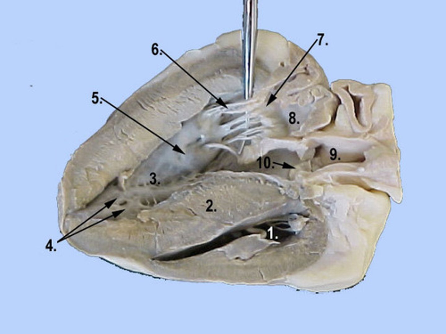 <p>Identify the chamber labeled 3</p>