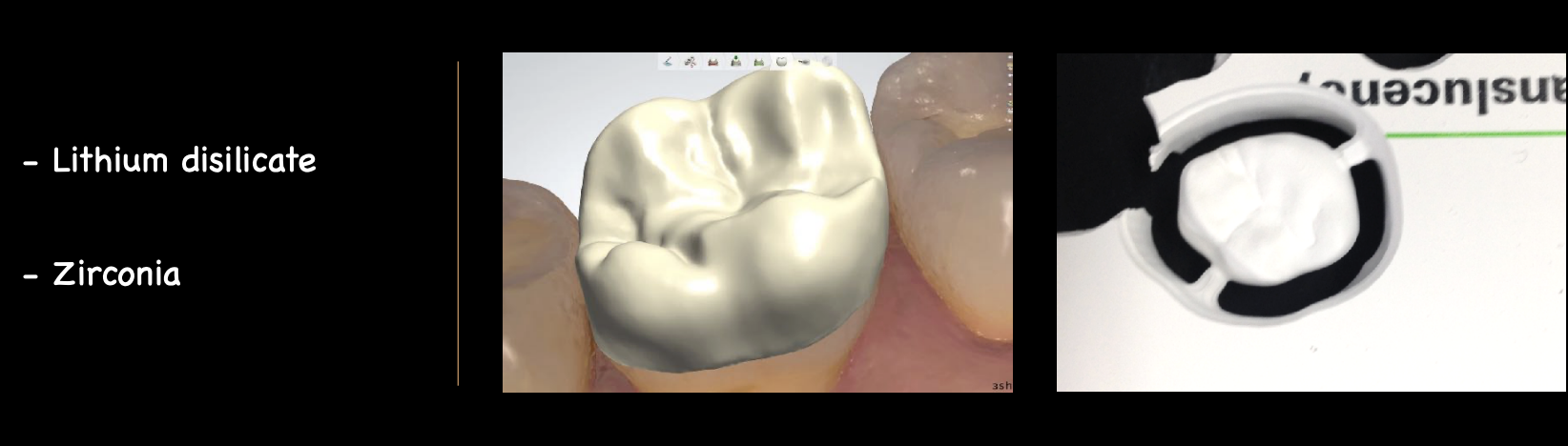 <p>posterior teeth for strength </p>