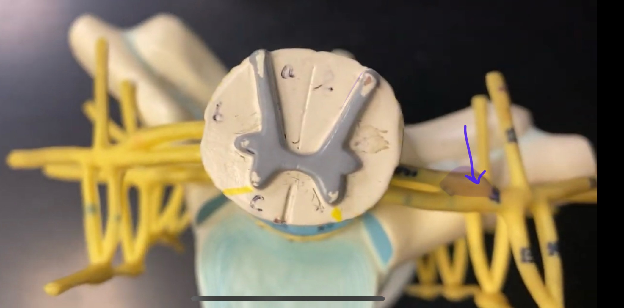 <p>What is the bulb here?</p>